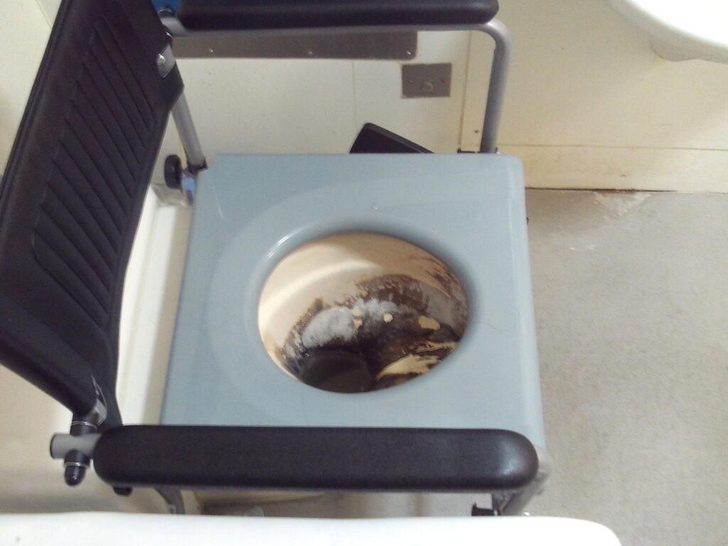 Photograph of a filthy toilet in a disabled prisoner's cell. Heavy staining to the bowl is visible.